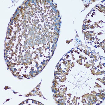 FDFT1 / Squalene Synthase Antibody