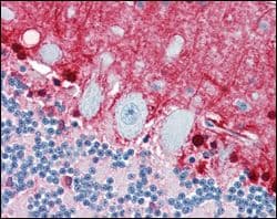 S100B / S100 Beta Antibody (clone 9A11B9)