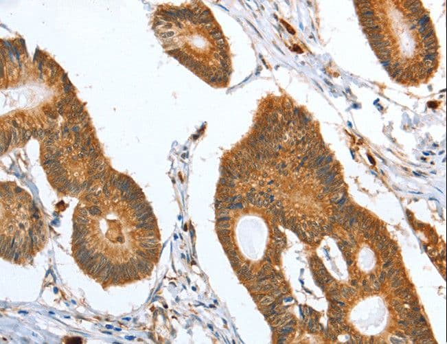 CAPG Antibody