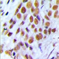 Polyclonal Rabbit anti-Human BRCA1 Antibody (C-Terminus, IHC, IF, WB)
