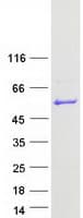 Human PUS3 Protein (Recombinant Myc-DDK (Flag))