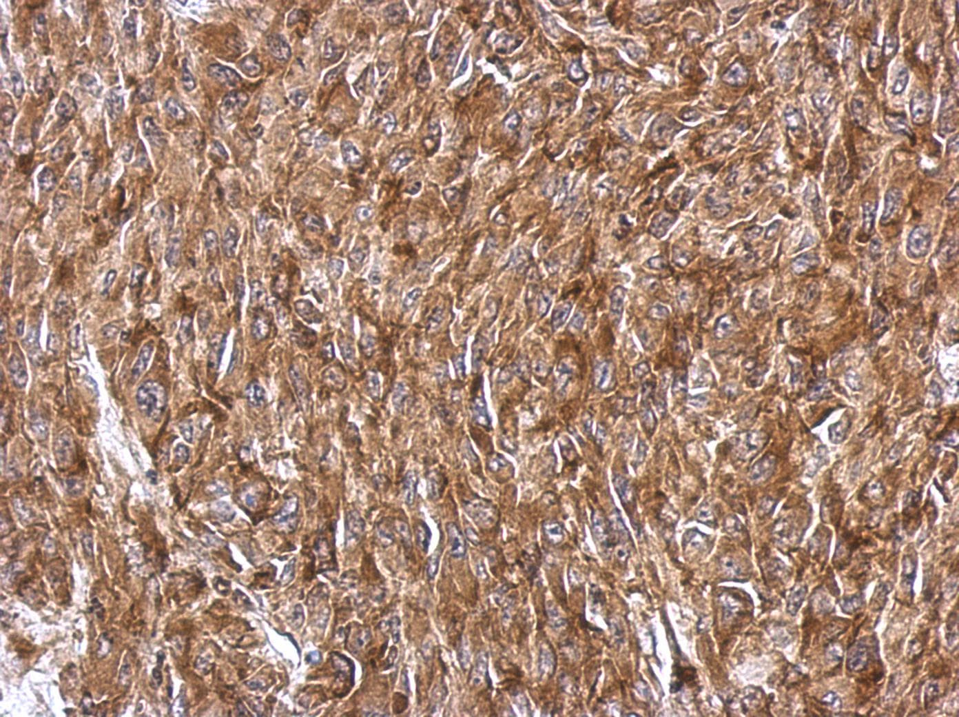 RPS3A / Ribosomal Protein S3A Antibody