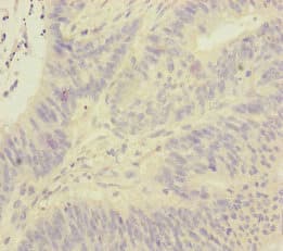 FOXRED1 Antibody