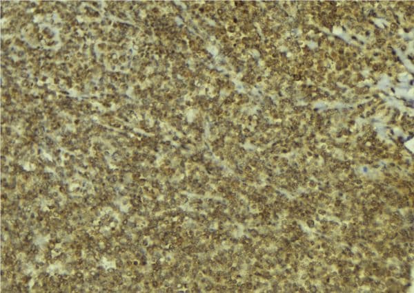 Polyclonal Rabbit anti-Human ESCO1 / ECO1 Antibody (IHC, WB)