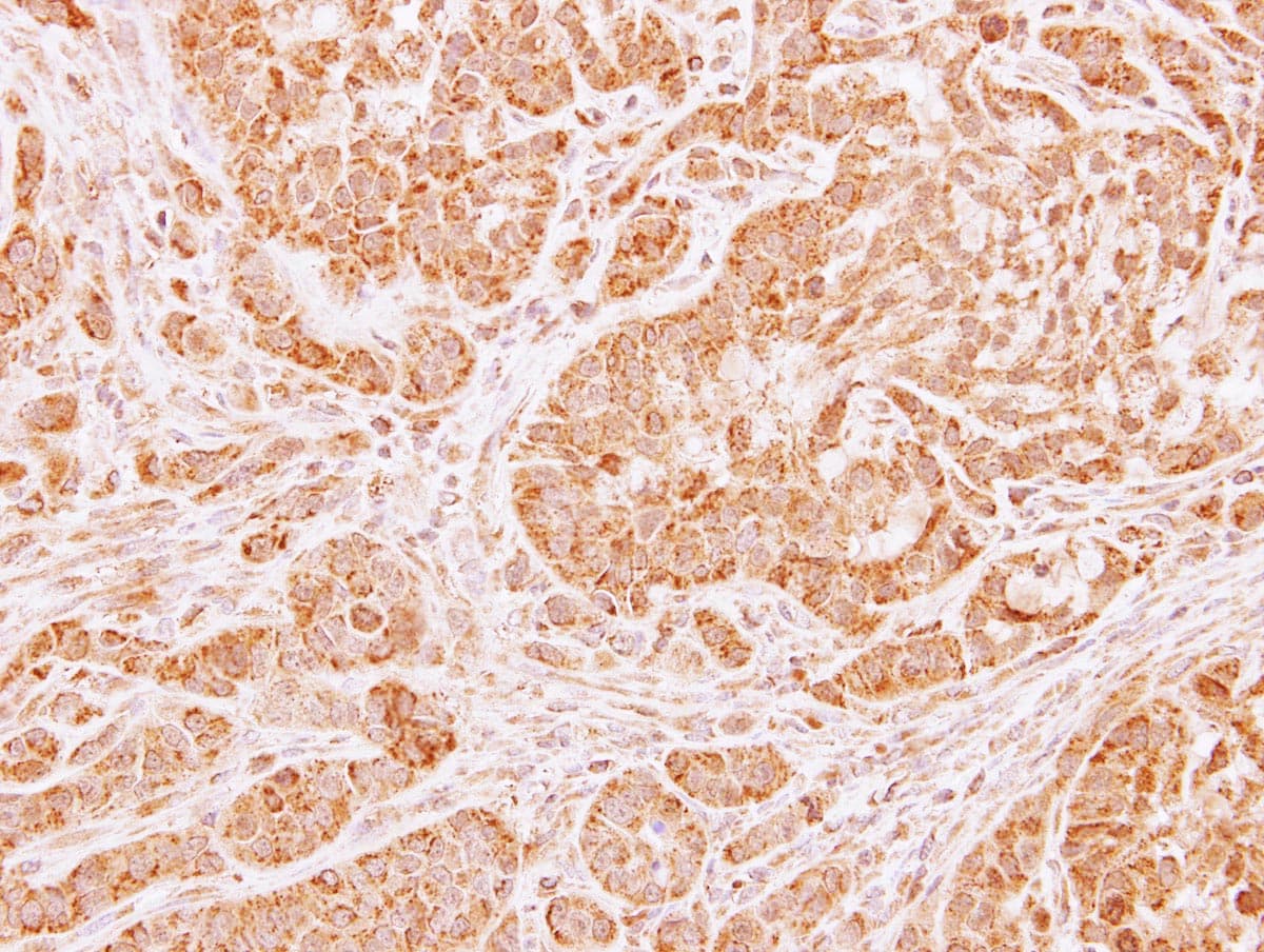 LARS2 / LEURS1 Antibody (aa181-458)