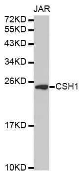 Polyclonal Rabbit anti-Human Placental Lactogen Antibody (IHC, WB)