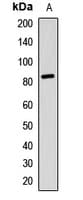 RPS6KA3 / RSK2 Antibody