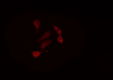 ADAR2 / ADARB1 Antibody