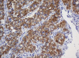 Monoclonal Mouse anti-Human GLB1 / Beta-Galactosidase Antibody (clone OTI1E10, IHC, WB)