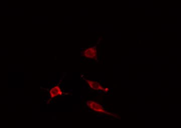 Polyclonal Rabbit anti-Human IQCB1 Antibody (IF, WB)