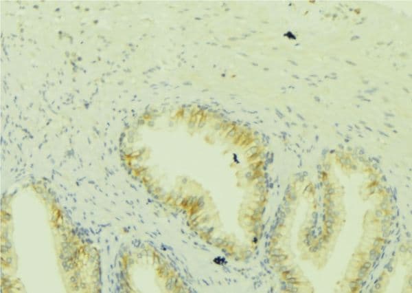 ICT1 / DS1 Antibody