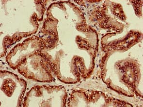 ST8SIA5 Antibody
