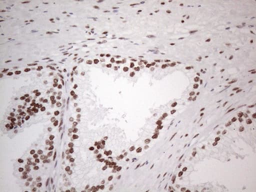 TP53BP1 / 53BP1 Antibody (aa1-300, clone OTI5E1)