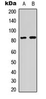 HSF1 Antibody (phospho-Ser303)