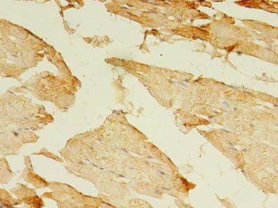 MYH7B Antibody