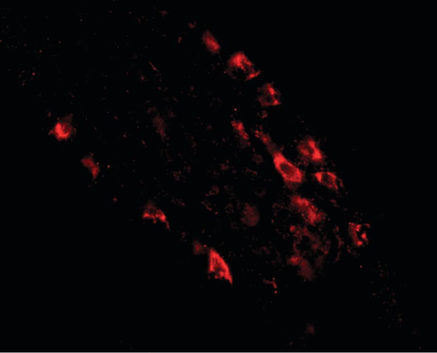 MEX3D Antibody