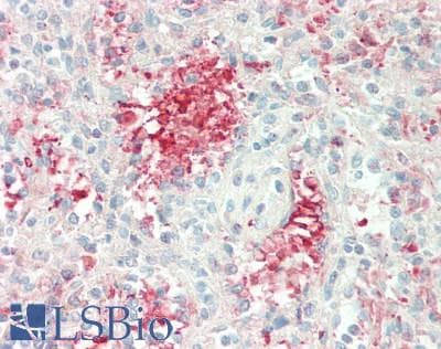 IHC-plus™ Polyclonal Rabbit anti-Human CCN5 Antibody (IHC, WB)