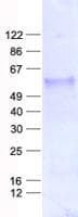 Human SFRP4 Protein (Recombinant His, N-Terminal)