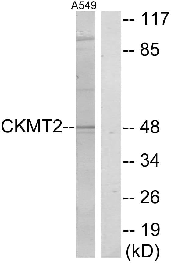 IHC-plus™ CKMT2 Antibody (aa231-280)