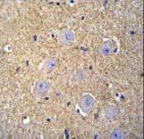 Polyclonal Rabbit anti-Human OR2T3 Antibody (aa280-308, IHC, IF, WB)