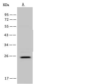 Polyclonal Rabbit anti-Human FAM156A / TMEM29 Antibody (WB)