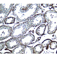 Polyclonal Rabbit anti-Human FAT10 / UBD Antibody (IHC, IF, WB)