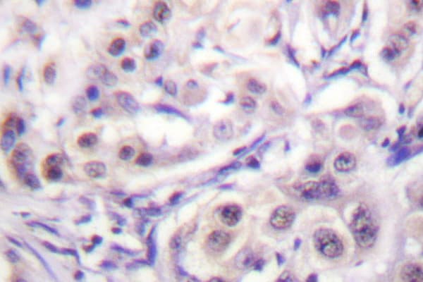 HNRNPD / AUF1 Antibody (His79)