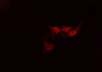 ACVR1B / ALK4 Antibody