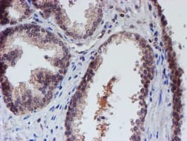 VCAM1 / CD106 Antibody (clone OTI4E8)