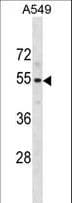 PUS10 Antibody (aa52-78)