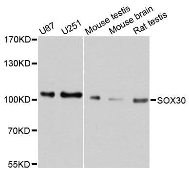 SOX30 Antibody