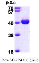 Human WDR5 Protein (Recombinant His)