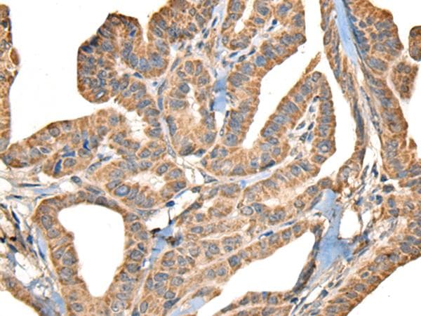 SLAMF7 / CRACC Antibody