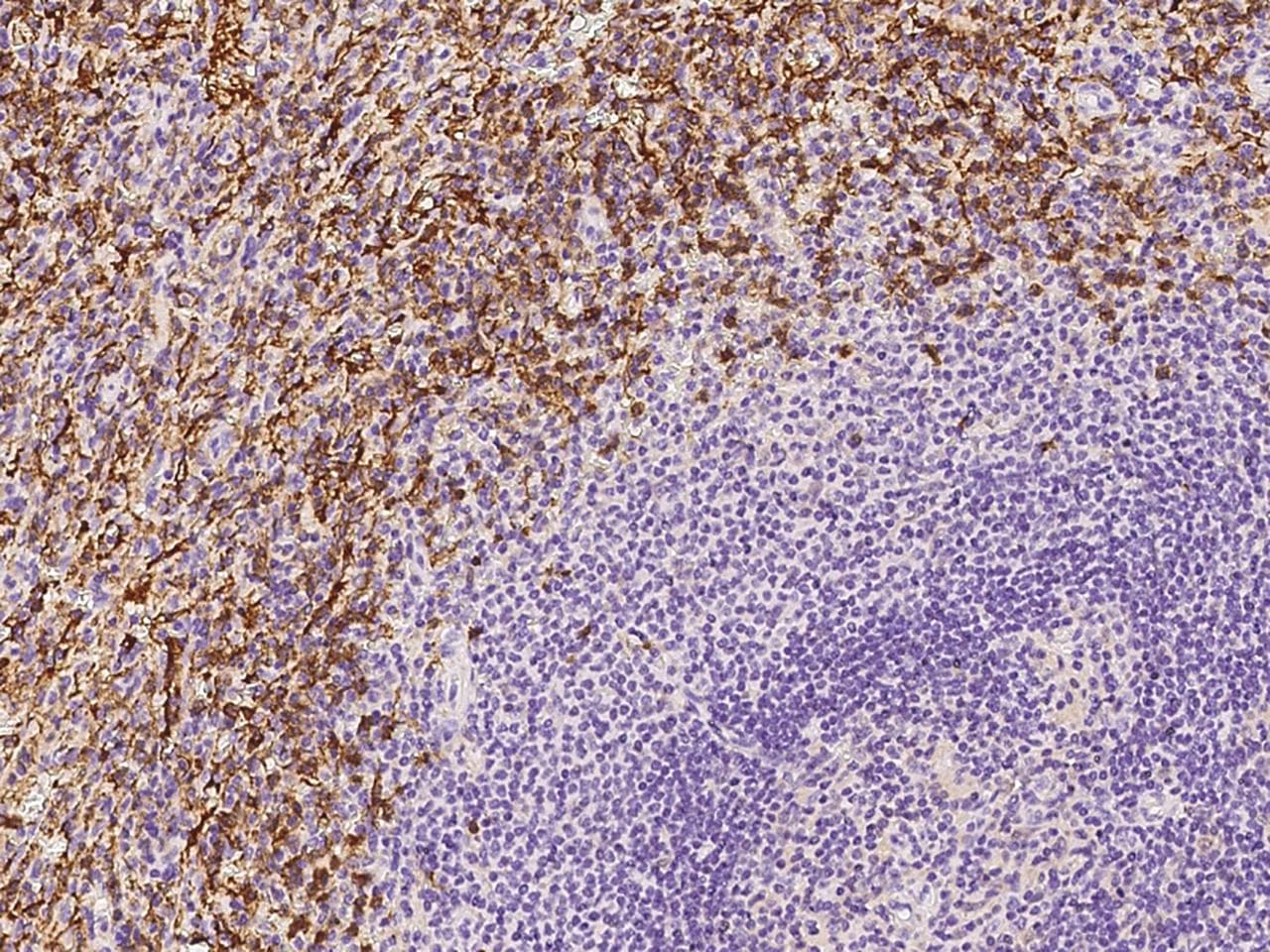 Polyclonal Rabbit anti-Human FCGR3A / CD16A Antibody (Preservative Free, IHC)