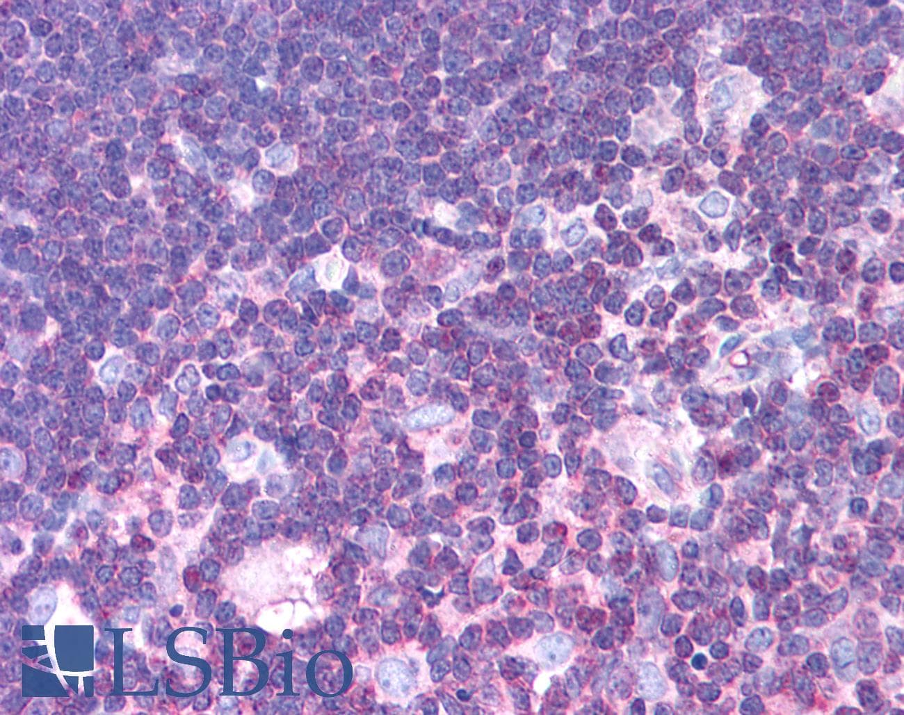 MLXIPL / CHREBP Antibody (aa800-852, Biotin)