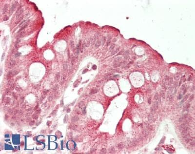 IHC-plus™ IL7R / CD127 Antibody