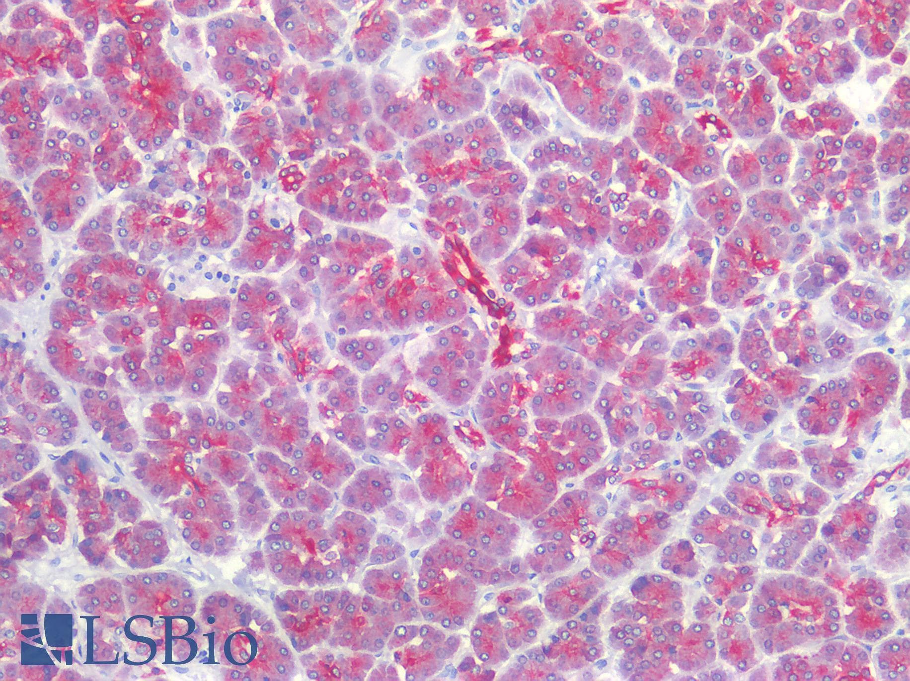 Polyclonal Rabbit anti-Human ST14 / Matriptase Antibody (C-terminal, IHC, WB)