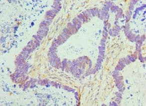 CTCF Antibody (aa1-260)