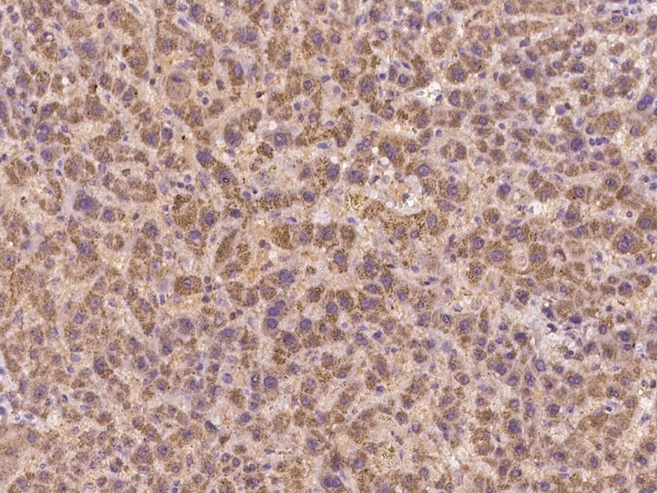 Polyclonal Rabbit anti-Human C17orf99 Antibody (IHC)