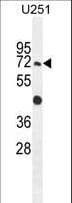 Polyclonal Rabbit anti-Human GPAA1 Antibody (aa46-73, IHC, WB)