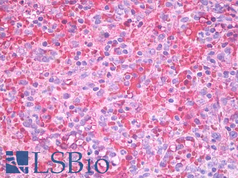 IHC-plus™ Hemoglobin Antibody (clone HB11-203.1)
