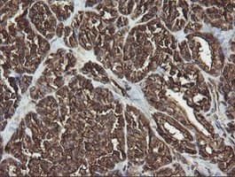 RAB30 Antibody (clone OTI3B1)
