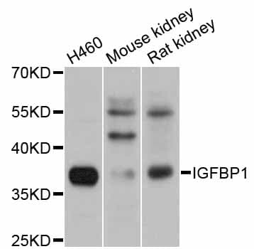 IGFBP1 Antibody