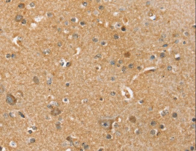 SLC41A2 Antibody