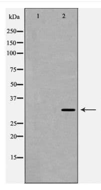 TNFAIP6 / TSG-6 Antibody