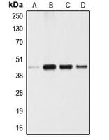 ANGPTL4 Antibody (Internal)