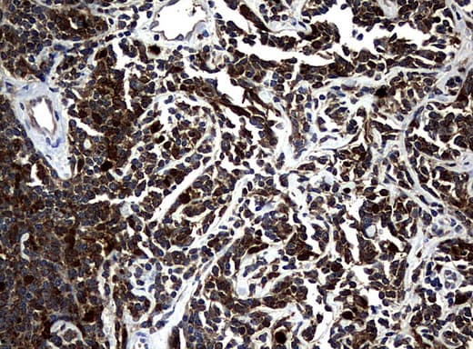 NME1 / NM23 Antibody (clone UMAB94)