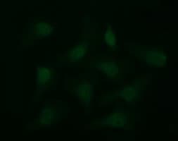 CD36 Antibody (clone OTI1B3)