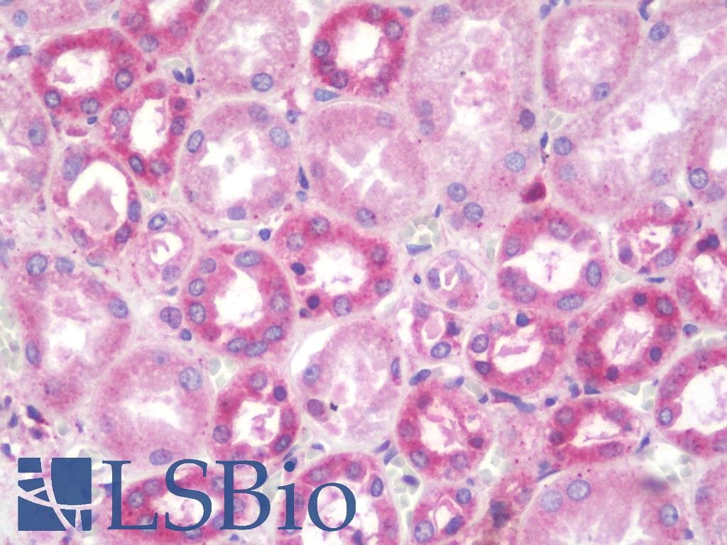 IHC-plus™ RBSN / Rabenosyn 5 Antibody (aa145-194)