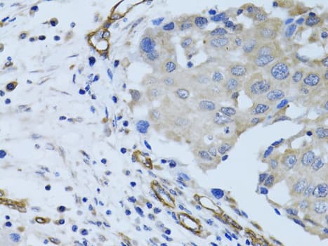 Polyclonal Rabbit anti-Human MCAM / CD146 Antibody (IHC, WB)